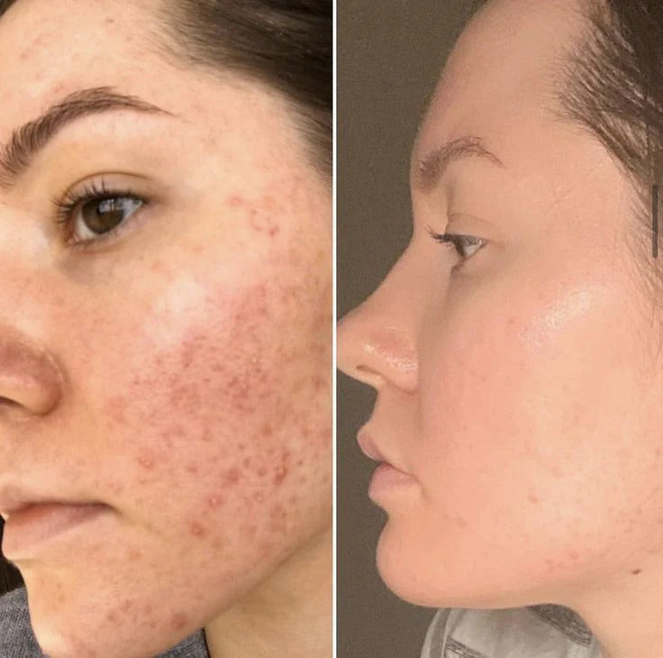 Luminic Clay Mask Stick™